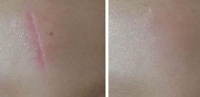 杭州非常受歡迎的隆胸醫(yī)師名單更新｜受眾稱贊的醫(yī)生推薦