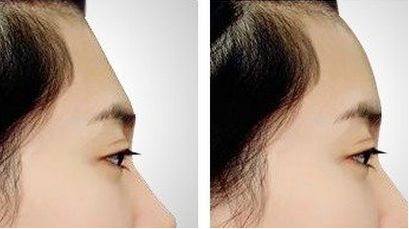 沈陽整形美容醫(yī)院鼻部整形?？祈敿?jí)醫(yī)院匯總，不容錯(cuò)過，速來圍觀