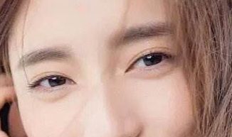 廈門盧藝樸：去眼袋術(shù)后驚艷臉龐，重拾年輕活力，醫(yī)生介紹鼎力推薦