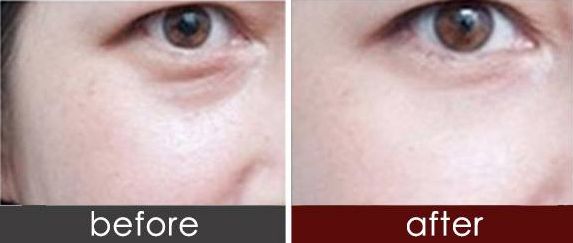 重點(diǎn)醫(yī)院盤點(diǎn)！西安脂肪抽取整形排行榜前十不容錯過！