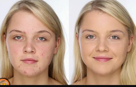 寧德醫(yī)美整形醫(yī)院哪家口碑比較好？雙眼皮價格查詢后的綜合評價如何？