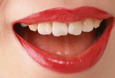 神奇！90天內(nèi)西安伍航利醫(yī)生雙眼皮見證，效果驚人