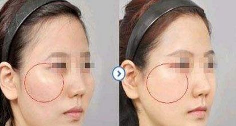 【2023版】浙江地區(qū)公立整形醫(yī)院疤痕治療排行榜TOP10最新發(fā)布！