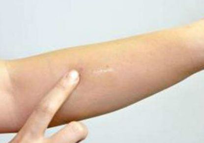 海南省人民醫(yī)院美容科的專家隊伍及醫(yī)學背景簡介