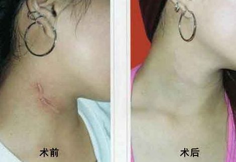 重慶乳房整形六大權(quán)威醫(yī)生盤點(diǎn)，高素質(zhì)專家排行曝光