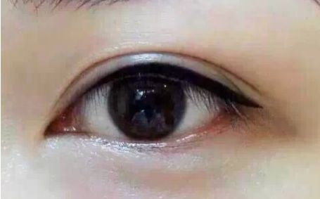 2023年四川明星雙眼皮專家全球發(fā)布丨郭祥文、郭波、肖海濤top5醫(yī)師介紹