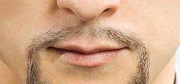 烏魯木齊市有口碑佳的整形醫(yī)院推薦！專業(yè)實力不容錯過！