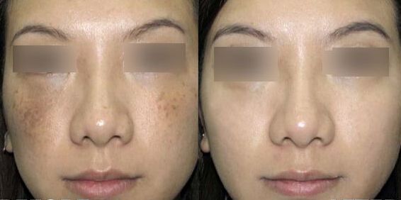 揭秘南京鼻王身份！專(zhuān)家盛贊前五強(qiáng)醫(yī)生，引人入勝！