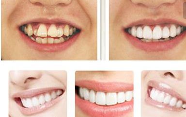 哪位醫(yī)生在北京最擅長鼻修復？不得不提的鼻整形專家！