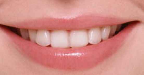 鄭州假體隆胸權(quán)威醫(yī)生推薦名單，值得信賴的選擇