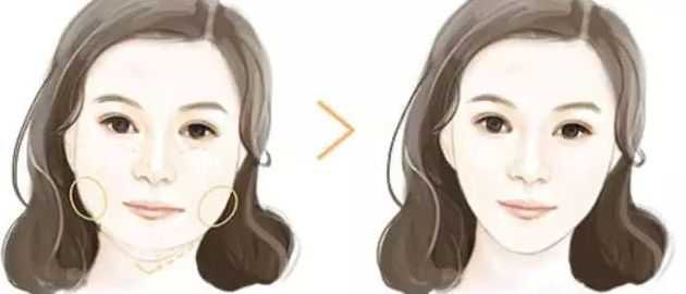 北京黎星醫(yī)生的面部脂肪填充效果如何？真實(shí)案例揭秘！