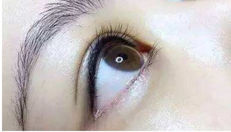 長沙哪位醫(yī)生在雙眼皮修復(fù)技術(shù)上口碑好找排名靠前的？