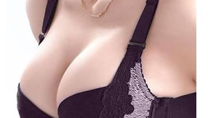 北京王光輝雙眼皮術(shù)后半年感受大揭秘！