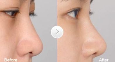 高效祛疤地，推薦的整形醫(yī)院在廣州！更有名口碑榜單盤點