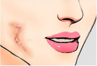 上海哪家醫(yī)美整形醫(yī)院口碑好？推薦排行：華美、時光、美萊等