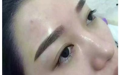 山西二院整形科的醫(yī)生名單更新及熱門項(xiàng)目?jī)r(jià)格表分享