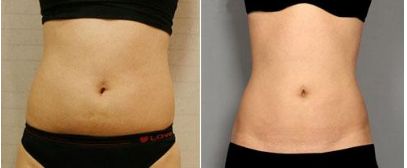 錦州美容整形科專家介紹及收費(fèi)明細(xì)表完善！