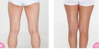 鄭州修復(fù)雙眼皮的專家推薦！這些醫(yī)院排名靠前、信譽(yù)有保障