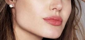 鄭州趙絳波卓越案例揭示——手術(shù)成功后煥然一新！