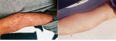 遼寧省近視治療醫(yī)院五佳榜單，這幾家醫(yī)院翹楚地位！