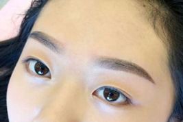 如何優(yōu)雅地擁有雙眼皮？了解專家經(jīng)驗與最新案例！