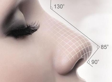 新鳴醫(yī)生：雙眼皮修復(fù)案例揭秘，分享給大家！