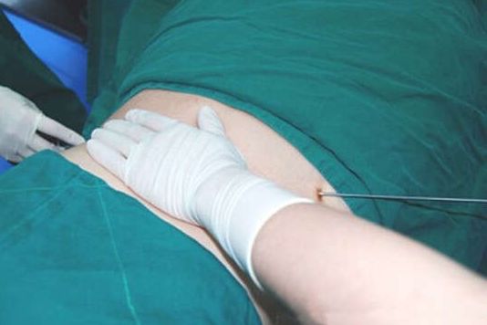 教您識別義烏隆鼻效果好的醫(yī)院！頂級機構推薦，芙洛拉、連天美站在年度精選之列！