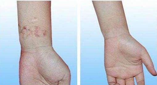 柴云醫(yī)生做雙眼皮后亮麗綻放！欣賞真實(shí)案例，驚艷非凡的視覺(jué)效果！