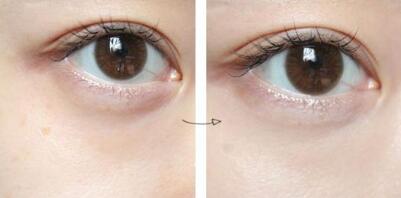 滄州隆鼻有哪些醫(yī)院可以做？如何選擇適合自己的醫(yī)院