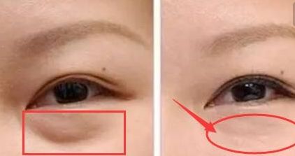 揭秘昆明雙眼皮明星醫(yī)生！驚喜榜單出爐，內(nèi)有杜海寬、王靜等大咖名醫(yī)！