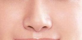 袁斯明醫(yī)生手術預約時效如何？祛疤效果有多好？解讀金陵醫(yī)院專家信息！