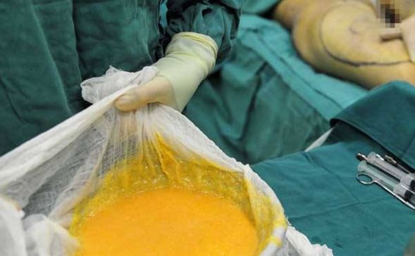 看準(zhǔn)這些專(zhuān)科醫(yī)院，清楚雙眼皮手術(shù)，哪家最靠譜？