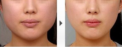 杭州美容醫(yī)院搶眼榜單，《格萊美醫(yī)療美容》與《連天美》齊名