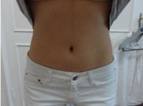 國(guó)內(nèi)知名雙眼皮大師推薦名單，附蘇薇潔、魏志香、王世勇等醫(yī)師！