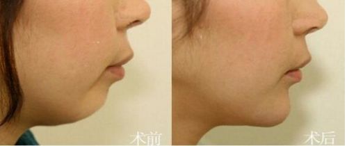 北京市前十名正頜醫(yī)院推薦：八處，協(xié)和，聯(lián)合麗格等，專業(yè)可靠！