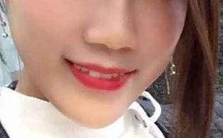 想要做隆鼻手術(shù)如何避免不好的經(jīng)歷？成功隆鼻必備指南！