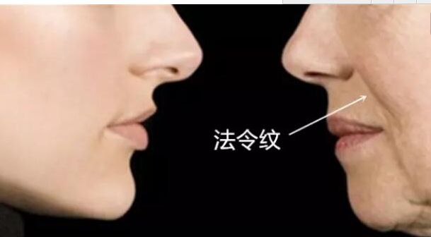 成都于曉波與肖海濤雙眼皮技術對比評測，看誰更出色