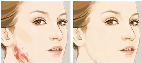 北京黃寺整形醫(yī)生資料及2023鼻部整形收費詳情揭秘！