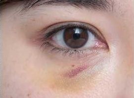 上海市那家醫(yī)療機構(gòu)的鼻整形效果較好呢？