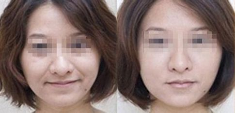 成都有哪些專(zhuān)業(yè)的雙眼皮整形醫(yī)生值得推薦？