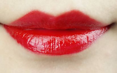 南京的施爾美整形醫(yī)院，讓孫欣恢復(fù)明亮清澈的雙眸