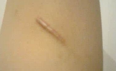 上海顧清整形哪家醫(yī)院好？看看口碑評(píng)價(jià)和隆鼻案例