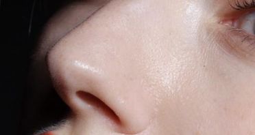 廣州植發(fā)領(lǐng)先的醫(yī)院推薦【技術(shù)認證方面有哪些】