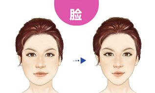 衡陽(yáng)附二可信度高的雙眼皮手術(shù)醫(yī)生與案例分享