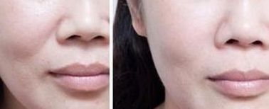 南通割雙眼皮醫(yī)生排行前八名名單公布！五星推薦供參考