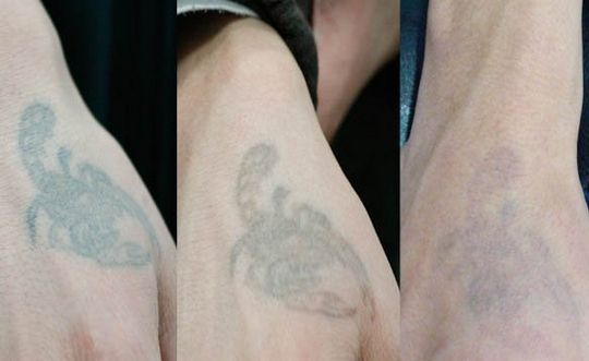 長(zhǎng)沙哪家整形醫(yī)院技術(shù)靠譜？私立醫(yī)美還可信嗎？