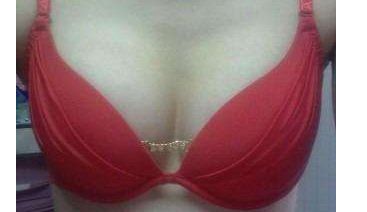 上海九院曹衛(wèi)剛墊下巴手術(shù)的技術(shù)實力如何？看看這里的基本信息和真實案例分享！