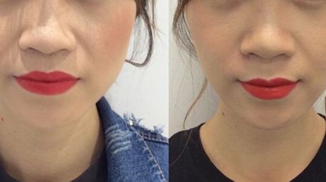 2023年熱議：揭秘重慶市當?shù)貥O具口碑的整容醫(yī)院！