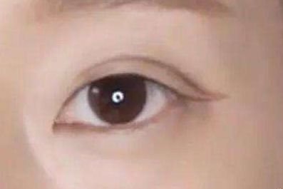 上海九院植發(fā)醫(yī)生劉清簡(jiǎn)介，用心解讀醫(yī)生信息！總結(jié)速查：上海九院植發(fā)醫(yī)師劉清，醫(yī)術(shù)高超！