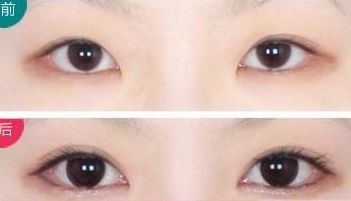 上海最受好評的乳房整形醫(yī)生推薦！超多病人贊賞王濤、何金光！